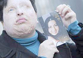 Ameneh Bahrami